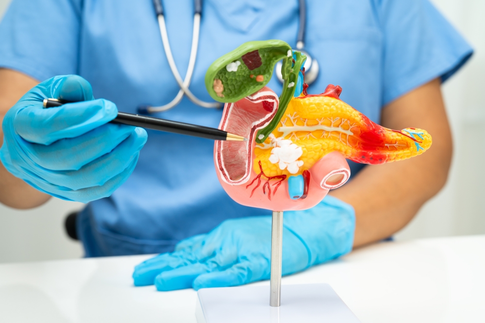 Scientists achieve pancreatic cancer breakthrough in mice pancreatic cancer