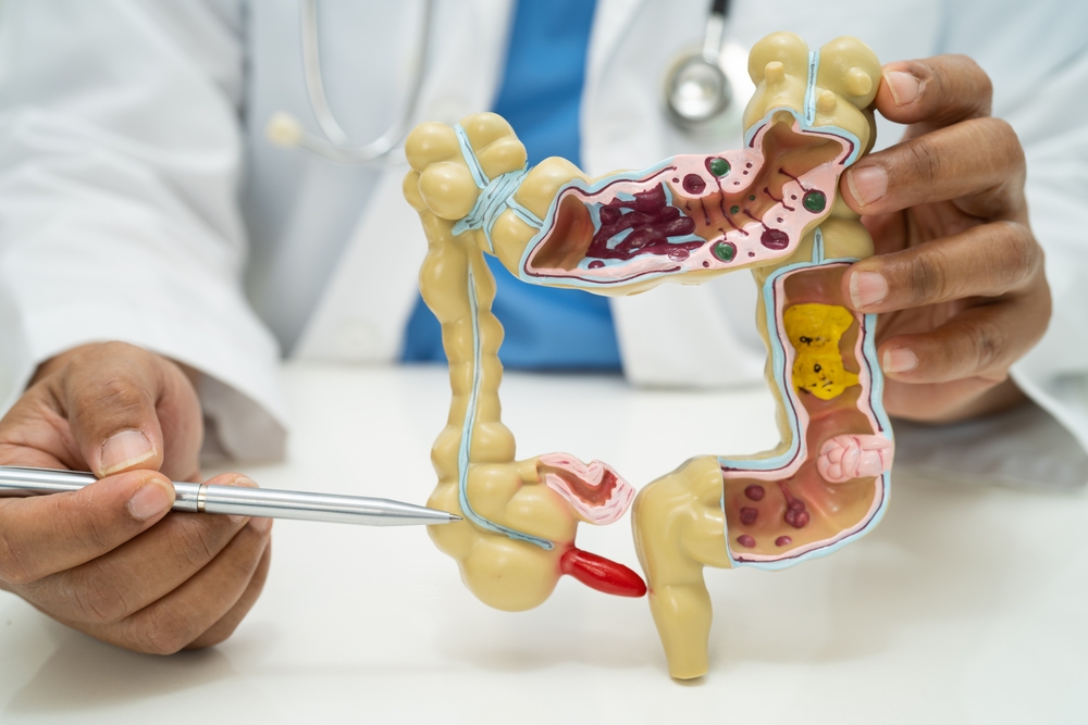 Appendix finally gets its moment as scientists uncover what it actually does Appendix